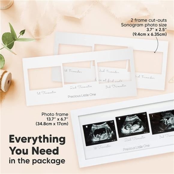 Sonogram Picture Frame - Trio Ultrasound Picture Frames  -  (Alpine White) - Picture 4 of 6